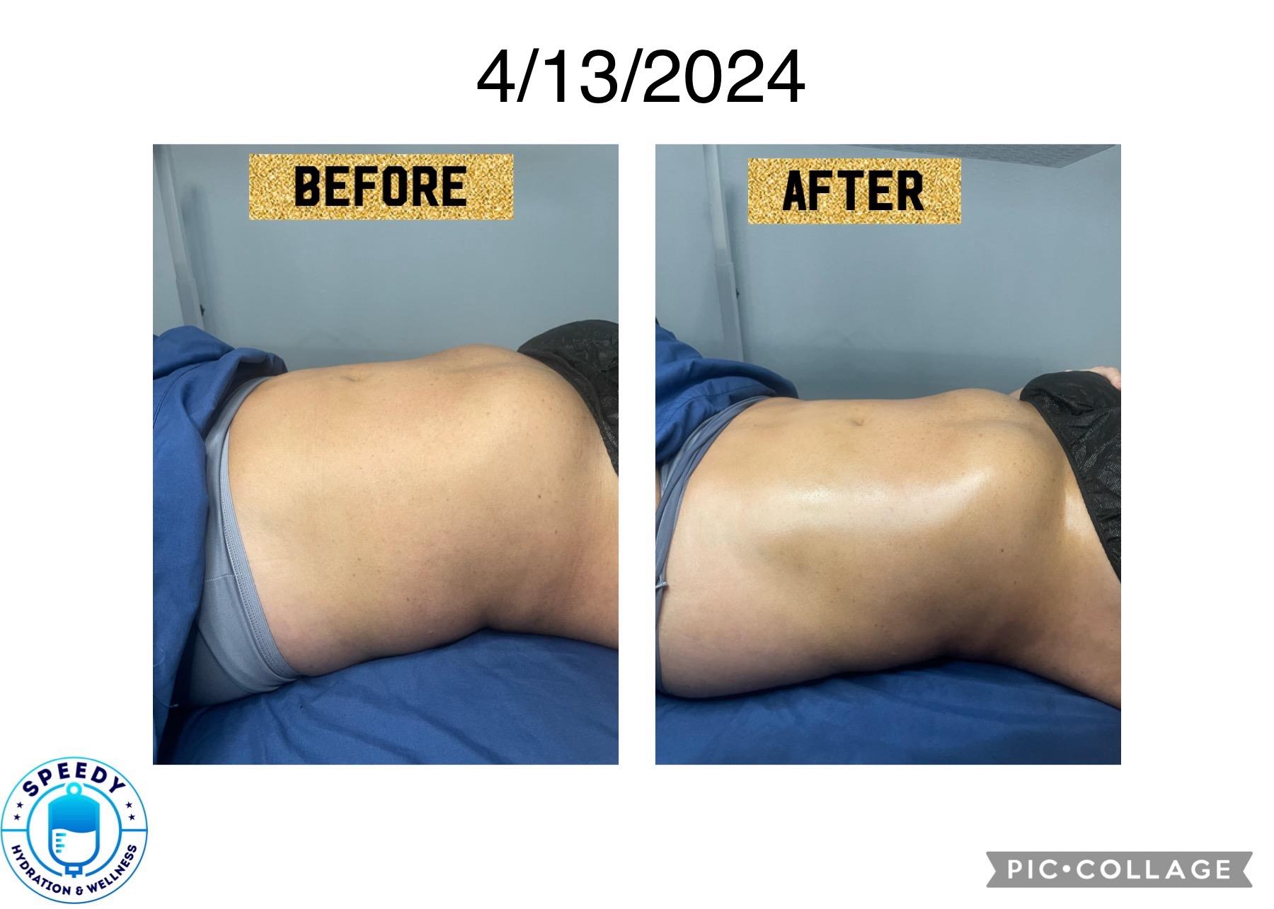 vitamin b12 injections in evans ga Injection at a Licensed Pharmacy How Long to See Results